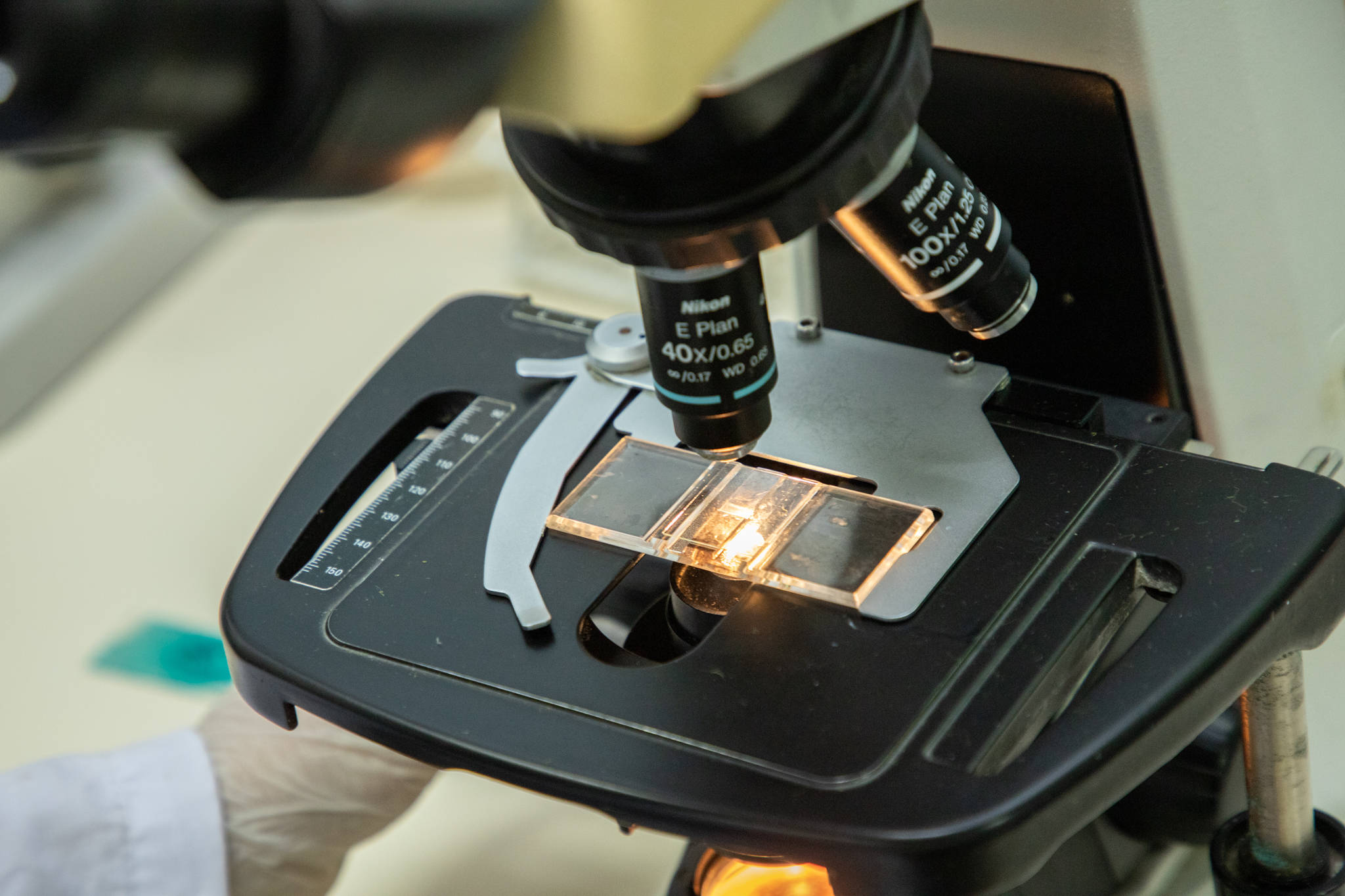 Prevalence of avian coccidiosis in peri-urban family farms in Argentina and Chile